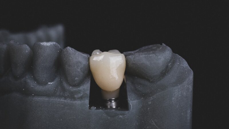 Dental: En Indgående Analyse af Dens Relevans og Betydning